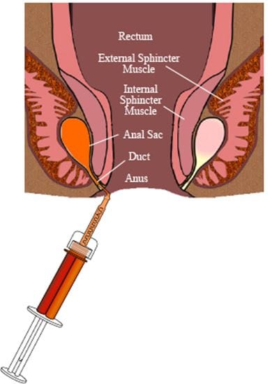 Analbeutel-Resektions-Set_0